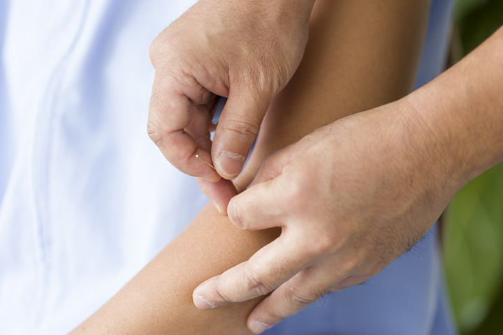 まこと鍼灸院 治療の様子